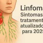 linfoma